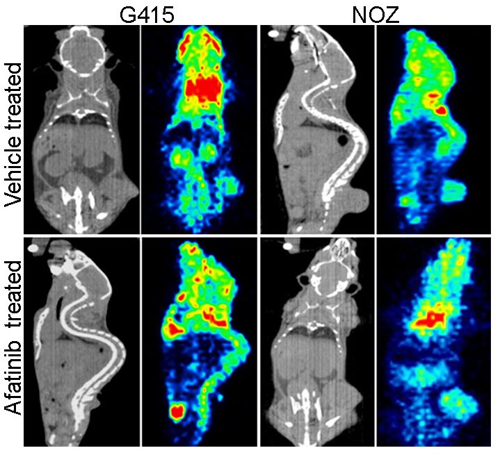 In vivo sensitivity of gallbladder cancer cell lines to EGFR inhibitor