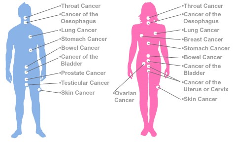 Common Cancers