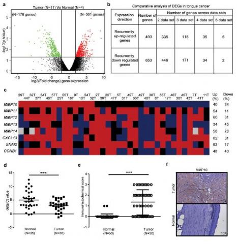 Differential expression profile of tongue squamous cell carcinoma using mRNA sequencing and meta-analysis identifies MMP10 up regulation.